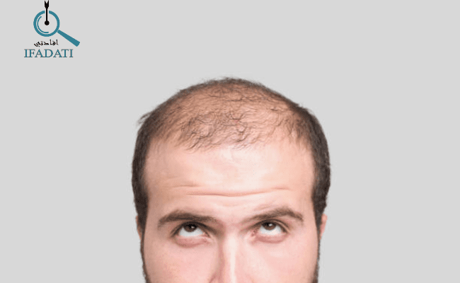 نمو الشعر