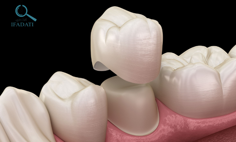 تاج الاسنان