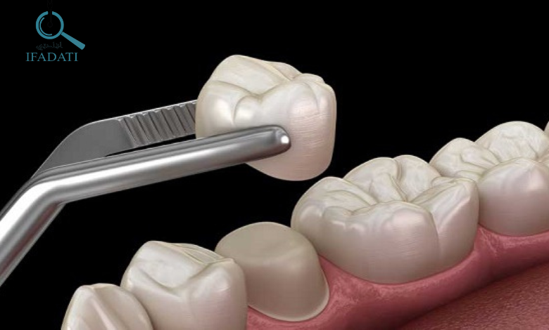 تاج الاسنان