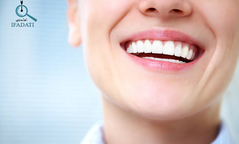 تبييض الاسنان