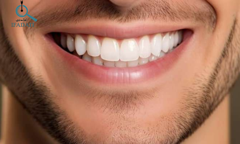 تبييض الاسنان
