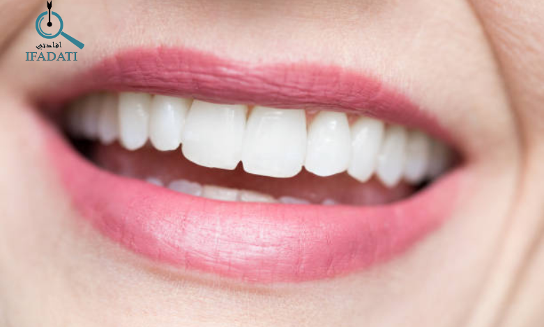 تبييض الاسنان