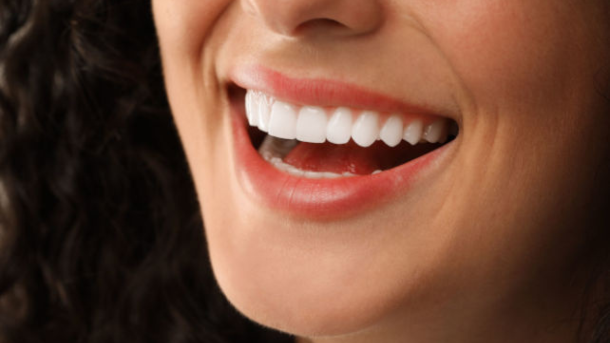 شكل الاسنان الطبيعي