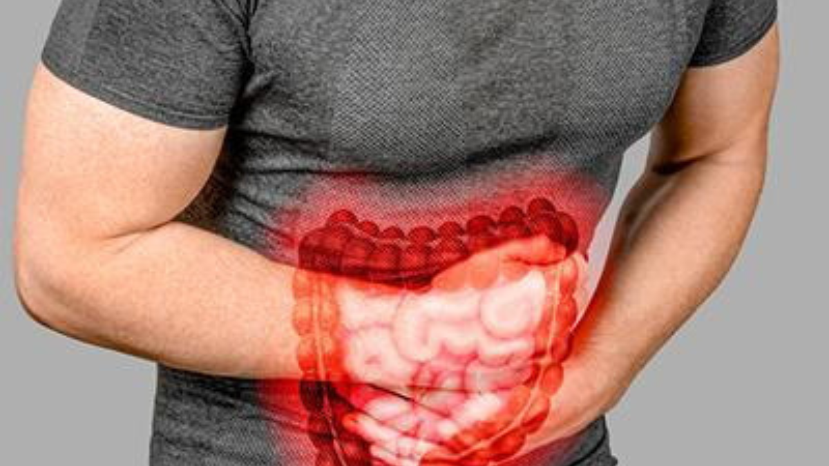 اعراض القولون العصبي