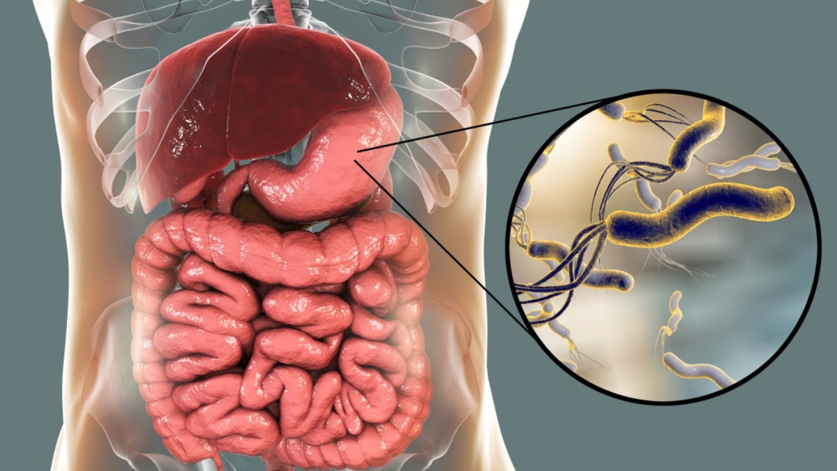 اعراض جرثومة المعدة