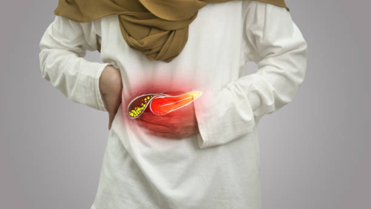 أعراض المرارة عند النساء