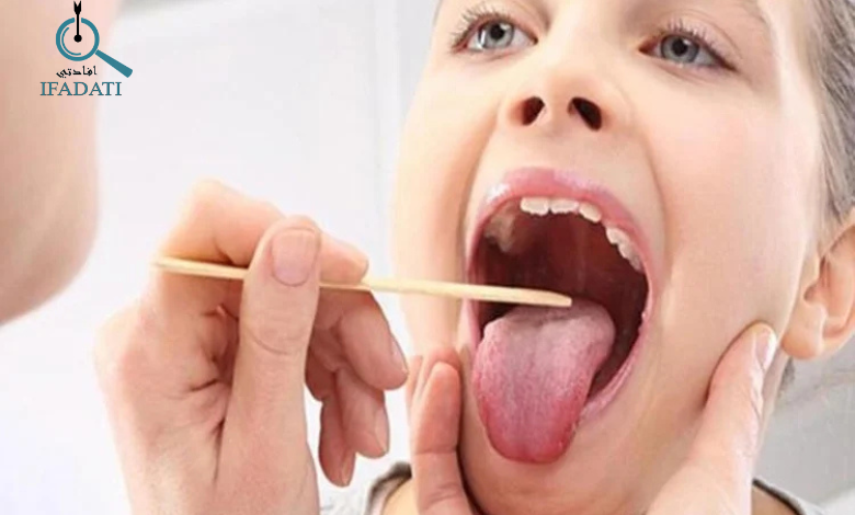 اعراض التهاب اللوزتين